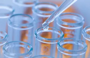 アレルギー検査